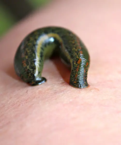 Are Leech Bites Dangerous?